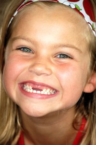 Girl Missing Two Teeth